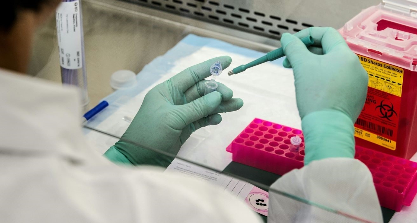 CDC scientist prepares biopsy sample for molecular testing in laboratory